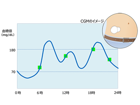 &ldquo;かくれ血糖&rdquo;を見える化してみよう！
